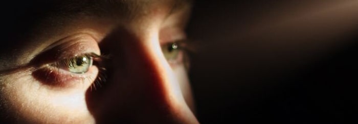 تیرگی دور چشم به دلیل کم خوابی