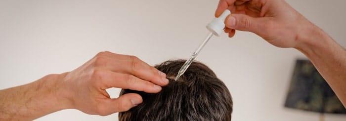 ماینوکسیدیل برای افزایش تراکم مو