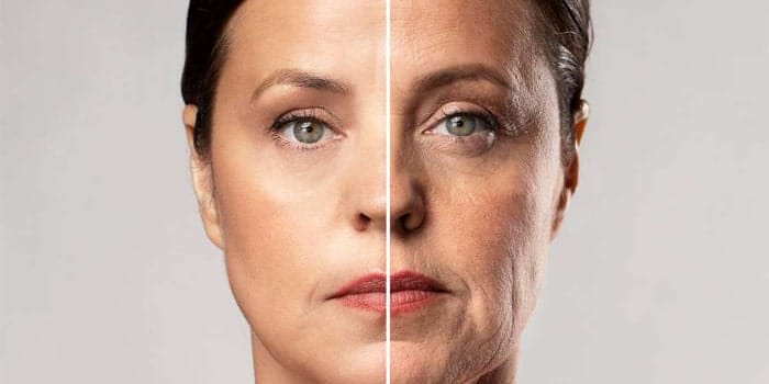 شل شدن پوست صورت به علت افزایش سن