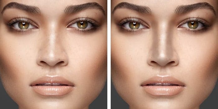 کانتور بینی پهن